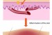 Natural Therapies For Eczema